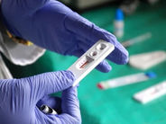 Եվրոպայում կտրուկ ավելացել է սեռական ճանապարհով փոխանցվող հիվանդությունների դեպքերի թիվը