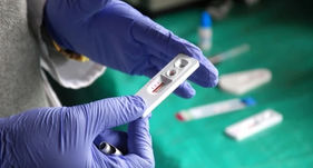 Եվրոպայում կտրուկ ավելացել է սեռական ճանապարհով փոխանցվող հիվանդությունների դեպքերի թիվը