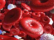 Blood.Երկու դեղամիջոցի համադրությունն օգնել է հաղթահարել արյան ագրեսիվ քաղցկեղը