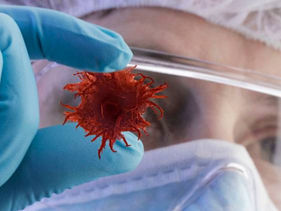 Ինչ հիվանդություններ և վարակներ կարող են հանգեցնել քաղցկեղի զարգացմանը. փորձագետների մեկնաբանությունները