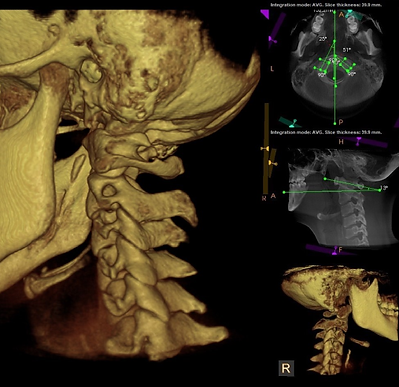 CBCT_1_.png
