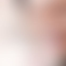 ✨ Как да поддържате резултата след избелване – грешките, които най-често допускаме