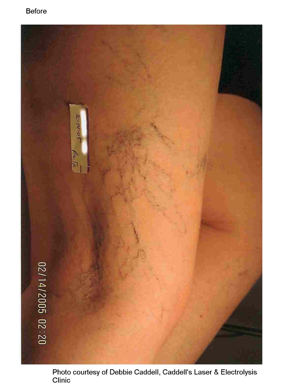 V_Leg_Caddell_01_B_right.jpg