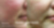 xeo_LaserGenesis_5.jpg