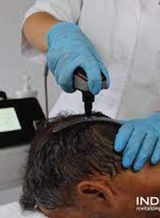 indiba hairwave.jpg
