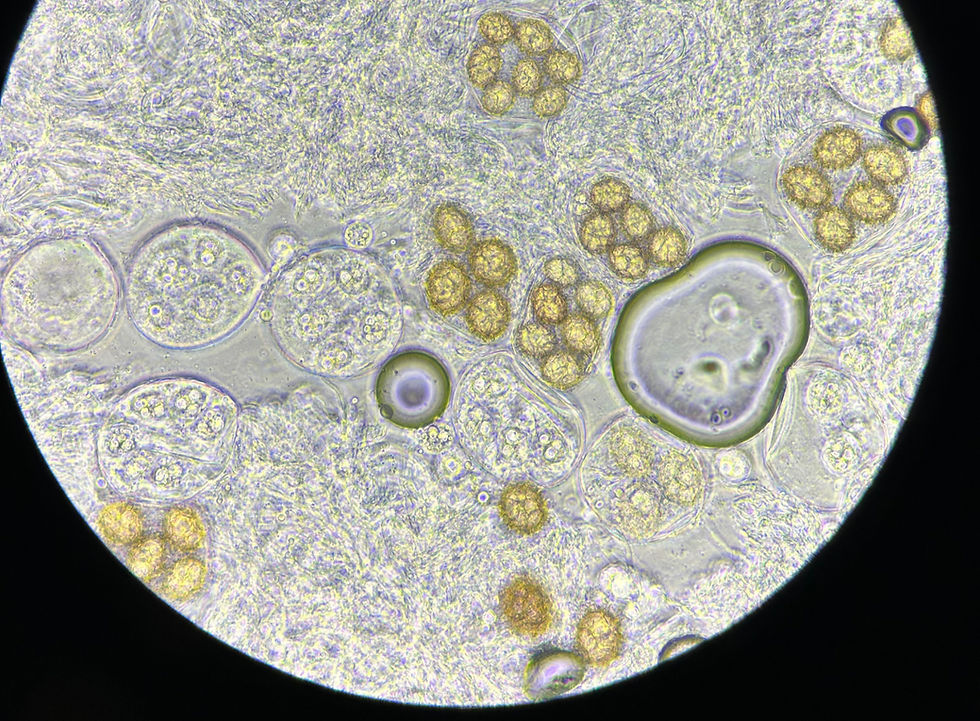 Spore di Tuber aestivum Vittadini a microscopio