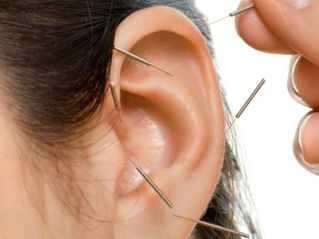 Ooracupunctuur & Auriculotherapie & Laser