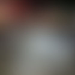 Múltiples heridos por siniestro vial en autopista