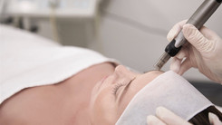 MICRONEEDLING +