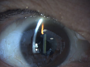 ICP 12789.jpg