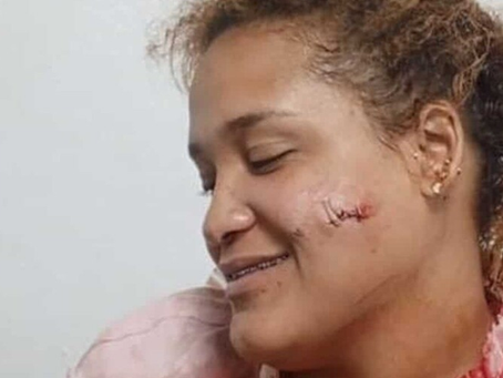 Violencia de pareja deja otra mujer herida en Puerto Plata
