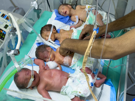 Muere otro menor por desnutrición severa en Gaza