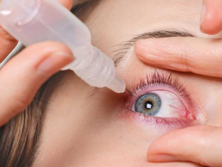 Conjuntivitis, una manifestación que puede estar asociada a la circulación de virus respiratorios