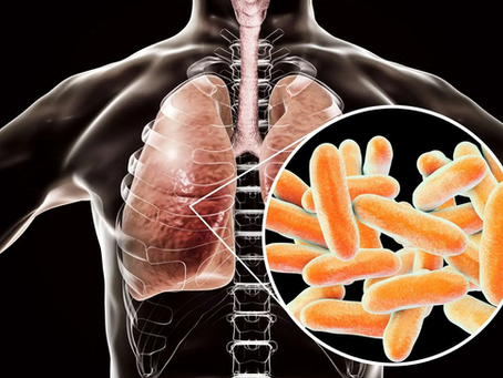 Cómo se propaga la bacteria de la enfermedad del Legionario