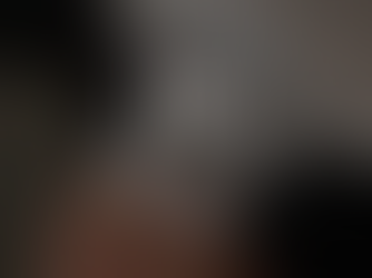 HIFU: liften en verstrakken zonder snijden