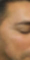 Wrinkles before.jpg
