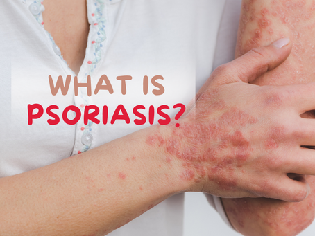 PSORIASIS