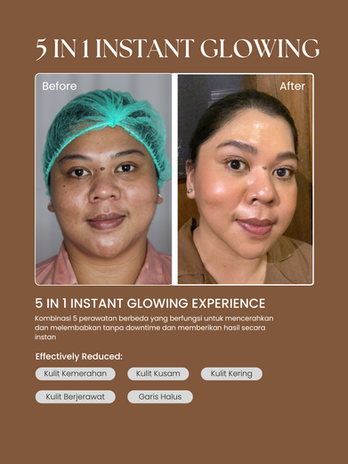 instant glowing, no injection treatment