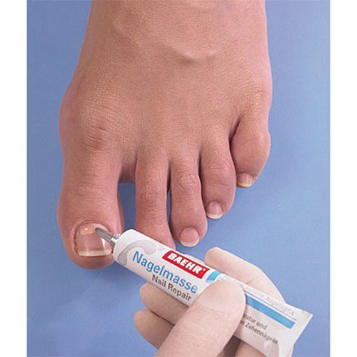 Thumbnail: Pedibaehr nail repair mass