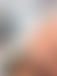 Non-Invasive Skin Lifting: How HIFU Reduces Wrinkles and Tightens Skin