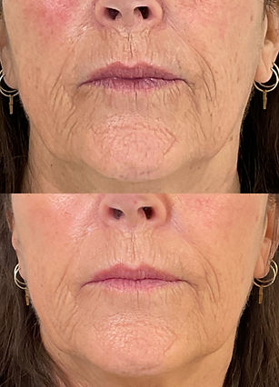 COSMETICNURSEASHLEE (14)_edited.jpg