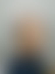 How Hair Micropigmentation Experts NYC Can Help You Get Your Swagger Back?