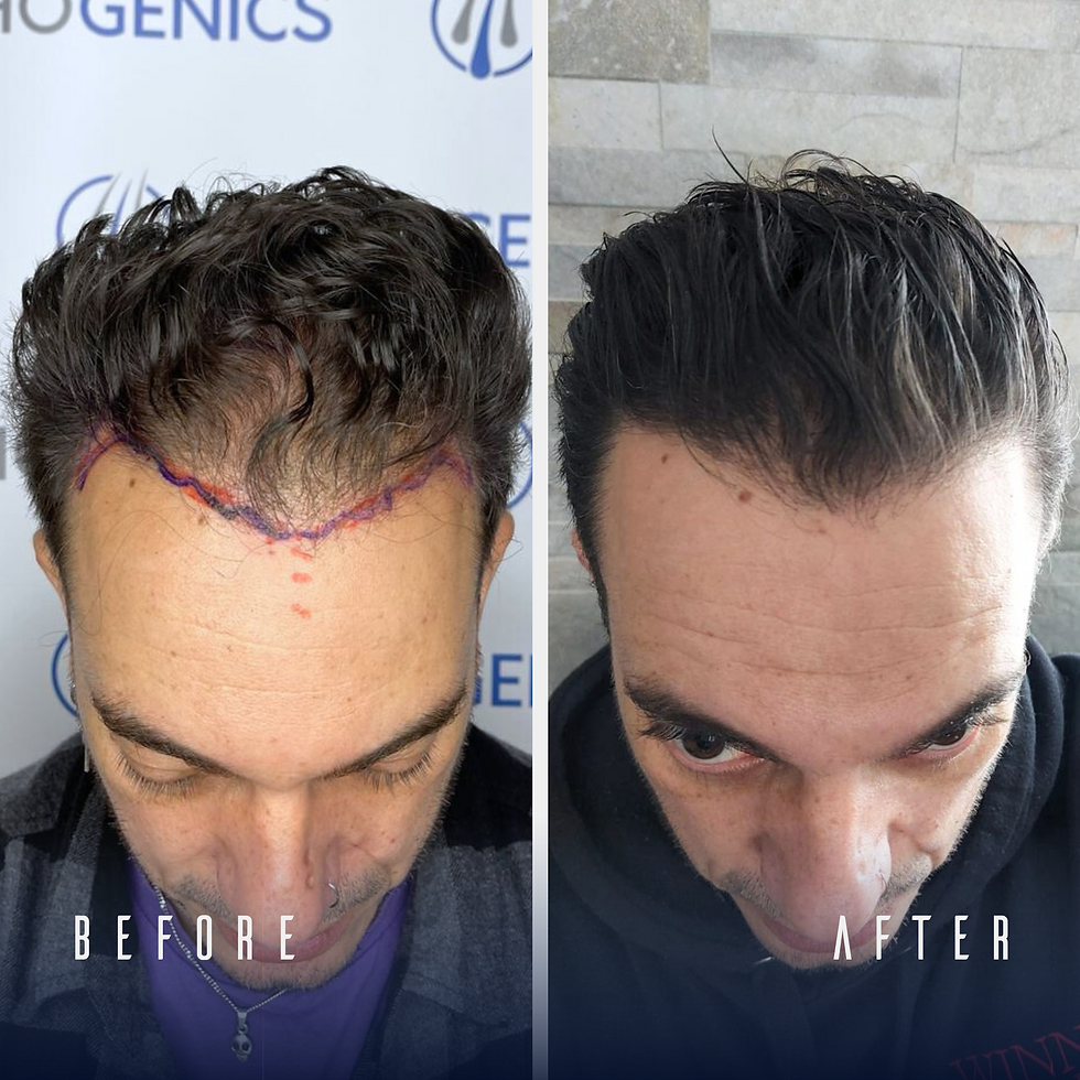Trichogenics Patient