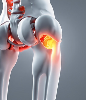 Pain in the hip joint.jpg