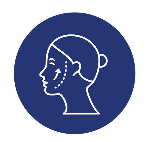 RITIDOPLASTIA