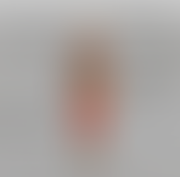 Anatomisches Diagramm, das den Domino-Effekt von verkürzten Hamstrings auf Becken, Wirbelsäule und Nacken zeigt, erklärt von Yogveda Yoga Bern.