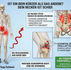 Anatomische Infografik zum Beckenschiefstand: Die Fehldiagnose eines kurzen Beins durch verkürzte Psoas- und Hamstring-Muskeln sowie die visuelle Analyse von Master Shahid Khan bei Yogveda Yoga Bern.