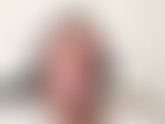 World Tip: acquirable