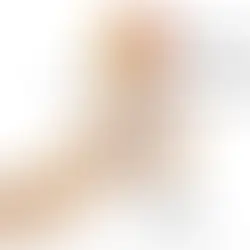 Posterior Tibial Tendon Dysfunction