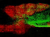 MB Axons through stem cells