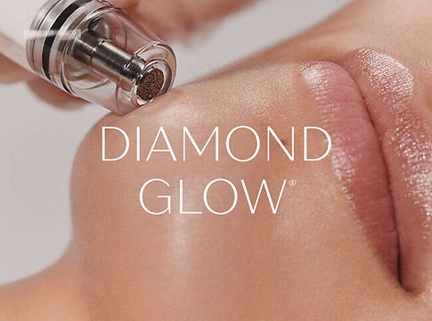 diamond-glow-e1681834198673.jpg