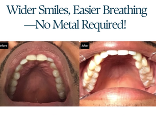 The Natural Expander Within: How Releasing Palate Tension Changes Everything