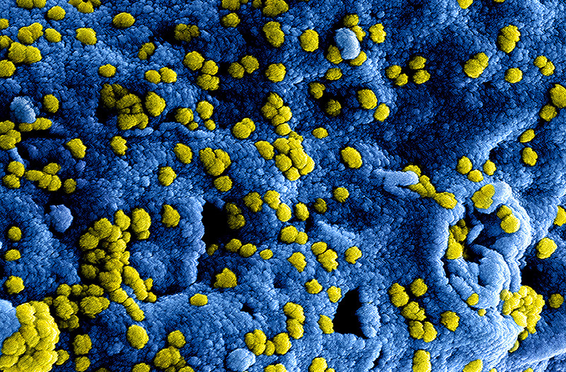 Economic Implications of the Coronavirus in Israel