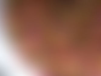 Ovos de Codorna Rosados com Creme de Mostarda