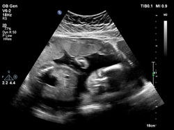 17041020190305_ANNELIES_2019030510572515