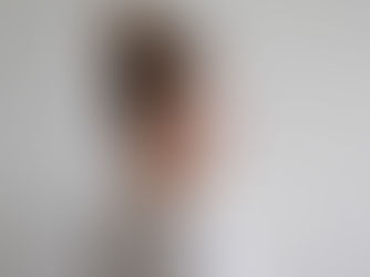 Tractional alopecia and the hairstyles that can contribute to it