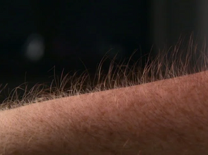 Laser Hair Removal FAQ's