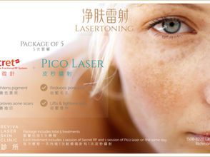 LaserToning Package of 5