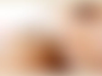 LaserToning Package of 5