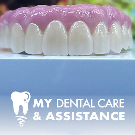 Turismo Dentale: Dalle Protesi Mobili alla Rinascita del Sorriso