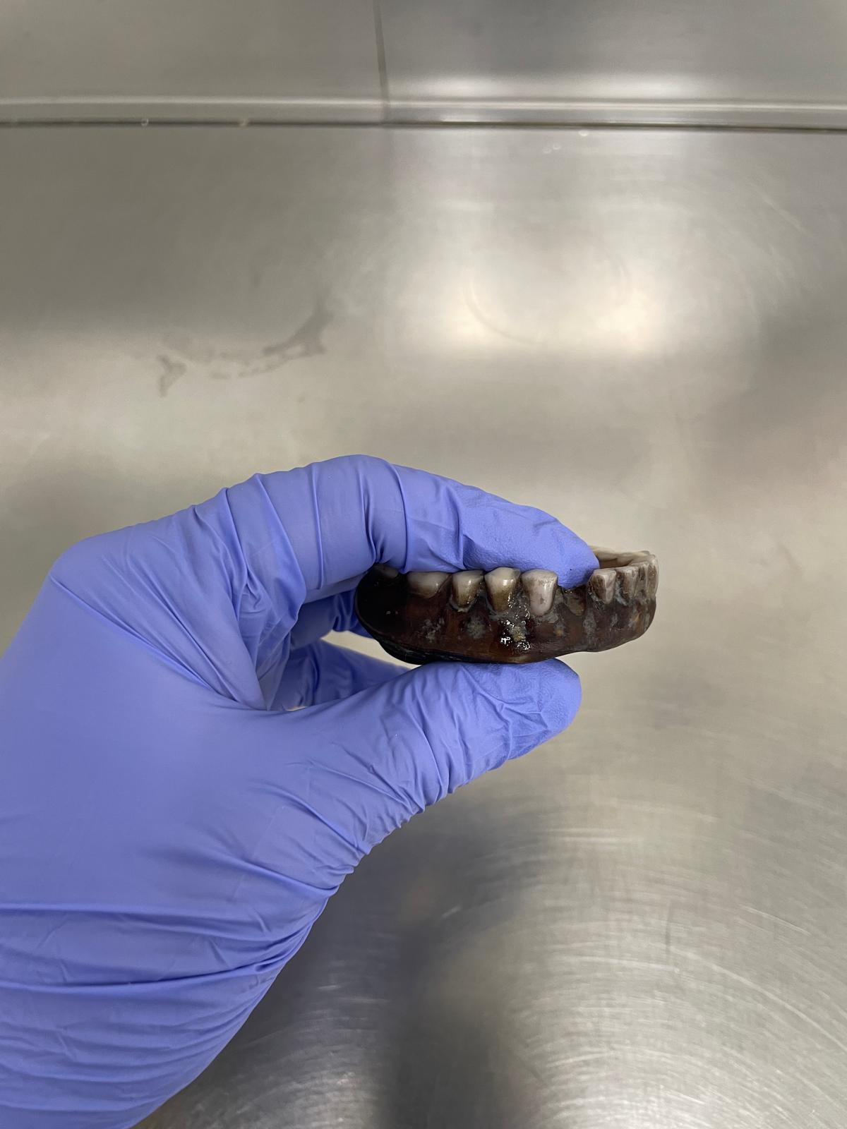 Denture after professional cleaning