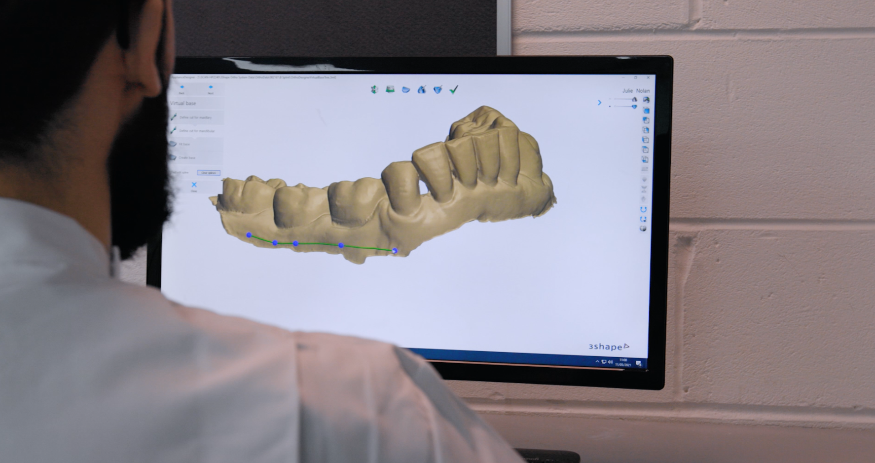 Aligner computer.png