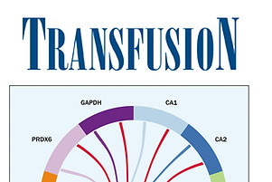 June 2016-Transfusion.jpg