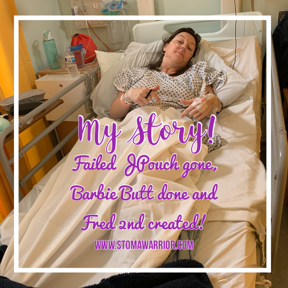 Failed JPouch Removal, Barbie Butt and Permanent Ileostomy Stoma all by