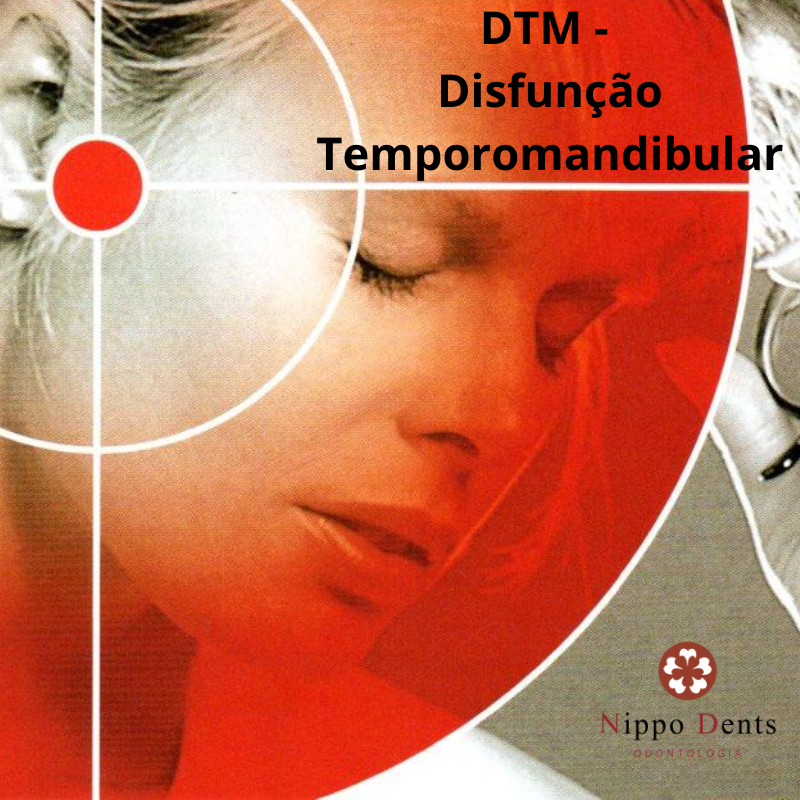 Disfunção Temporomandibular