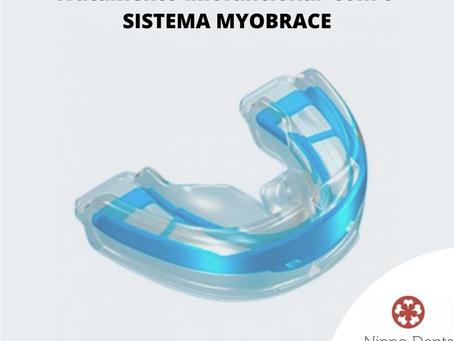 
Tratamento Miofuncional - MYOBRACE